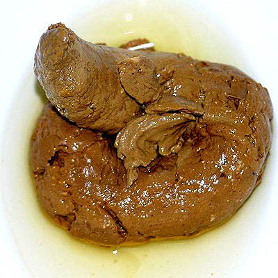 hovno